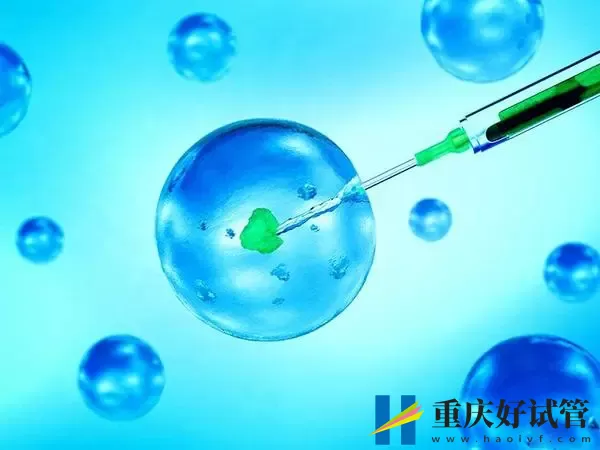 无输精管能否做试管婴儿(图1) 无输精管能否做试管婴儿(图1)