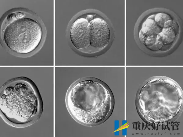 试管婴儿的胚胎等级如何划分(图1) 试管婴儿的胚胎等级如何划分(图1)
