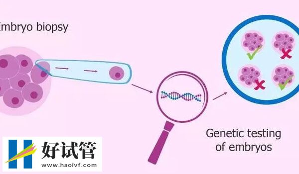 三代试管生男孩多少钱(图1) 三代试管生男孩多少钱(图1)