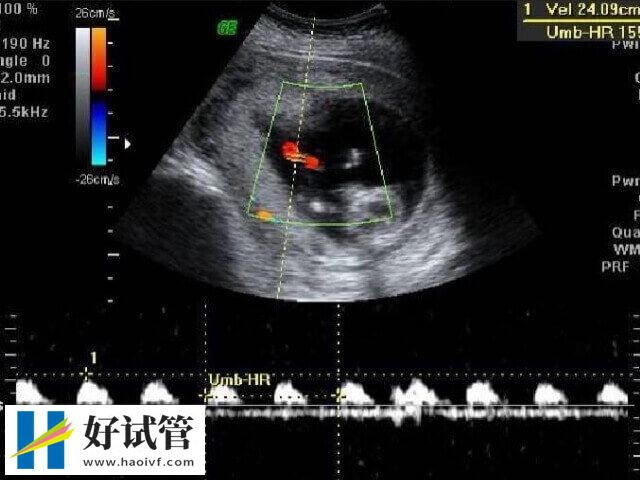 怎么样推算排卵期(图1) 怎么样推算排卵期(图1)