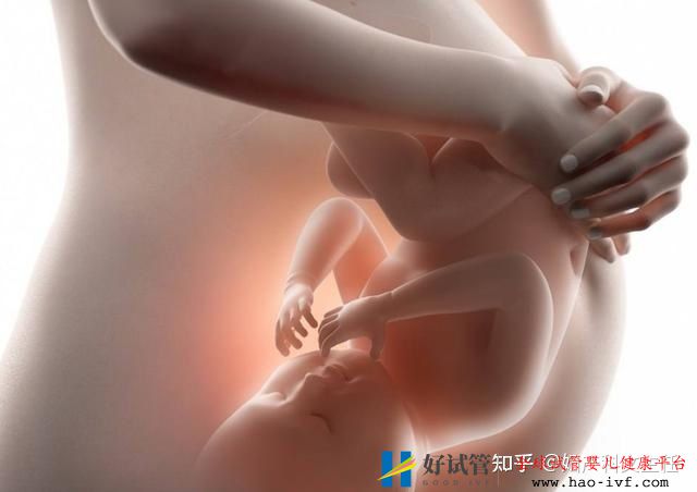 试管婴儿多少钱一次为什么医生不建议做双胞胎(图5) 试管婴儿多少钱一次为什么医生不建议做双胞胎(图5)
