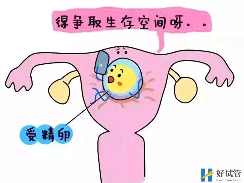 宫腔粘连的症状对试管婴儿成功率有着重大影响(图2) 宫腔粘连有多种治疗方式